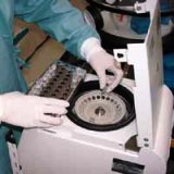 VNTR型別解析
